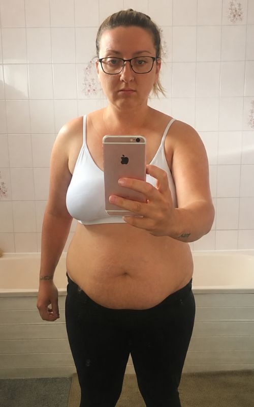 Ami before losing 66 lbs
