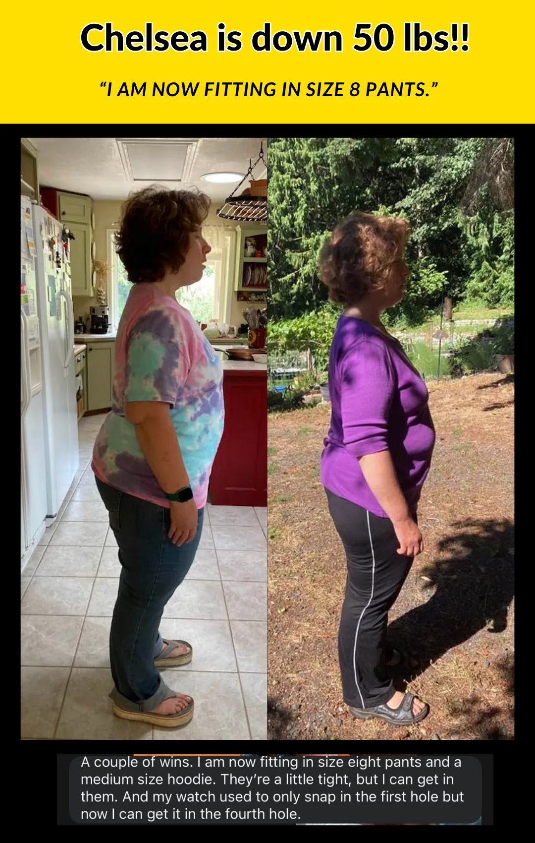 Chelsea transformation